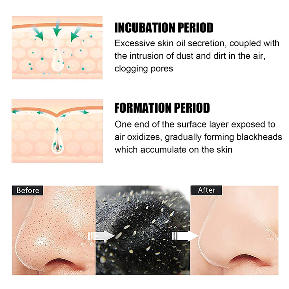 10/20/50/100PCS Nose Blackhead - đánh giá và giá Charcoal Pore Strip