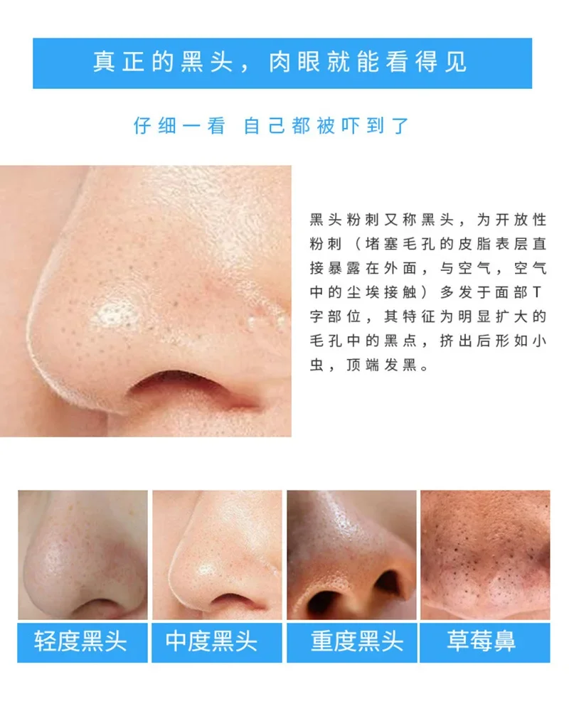 30 Pcs Bamboo Charcoal Nose St - đánh giá và giá Charcoal Pore Strip