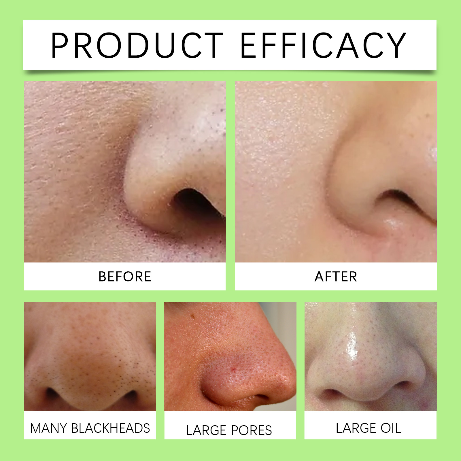 Bamboo Charcoal Nose Strips fo - đánh giá và giá Charcoal Pore Strip